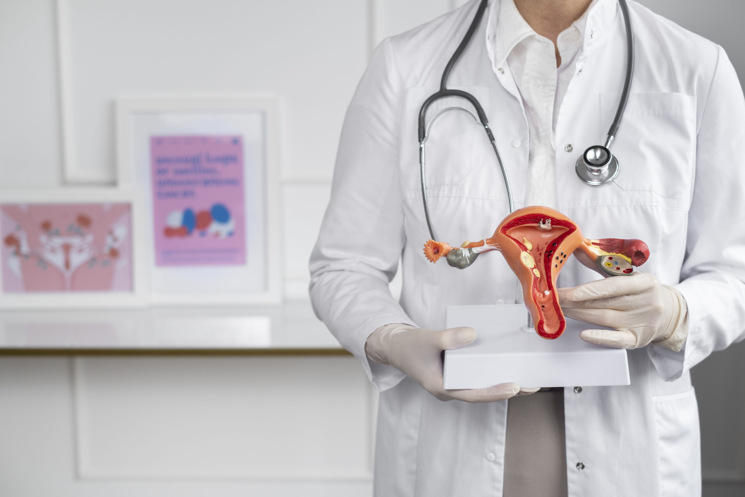 ENDOMETRIOSIS