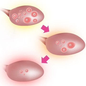 Fertility