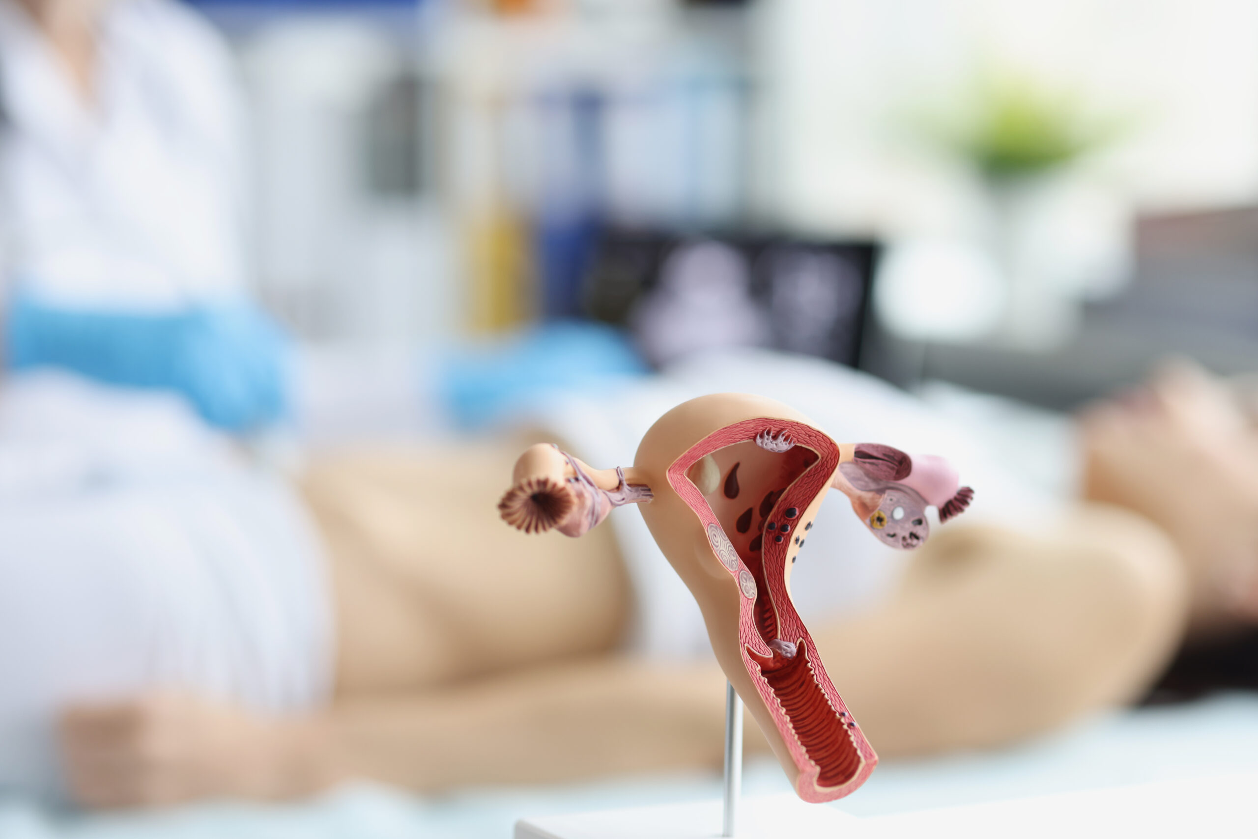 Ovulation Induction