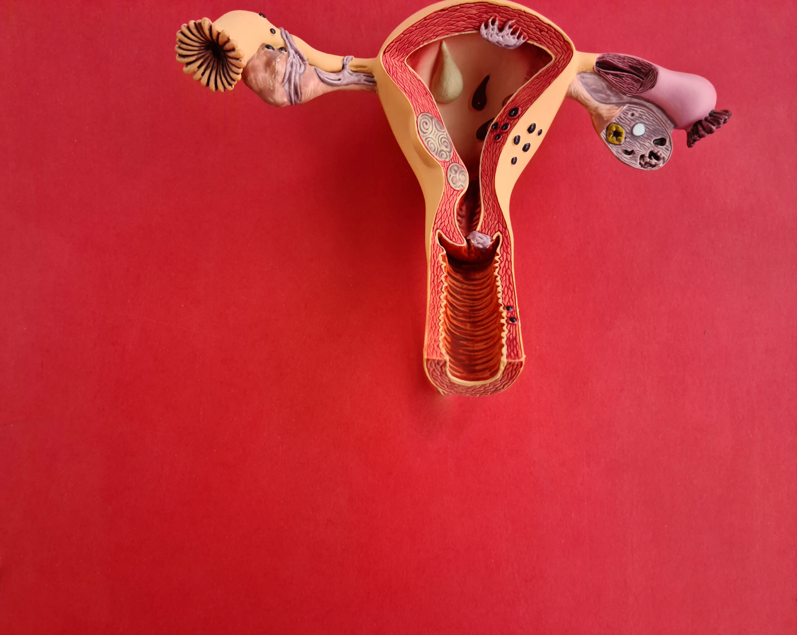 Perimenopause