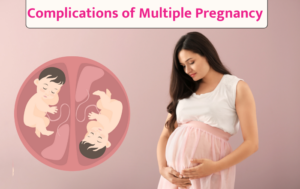 Complications of Multiple Pregnancy