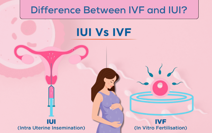 What’s the Difference Between IVF and IUI?